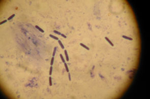 2011-05-sero-micro