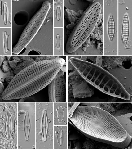Des diatomées vues au microscope. Image tirée de l'étude Vassal V., Heudre D., Wetzel C.E. & L. Tudesque. (2023). Two new Achnanthidium (Bacillariophyceae) species from a recent Alpine lake in National Park of Ecrins (South of France). Nova Hedwigia Beiheft. Nova Hedwigia, Special Issue, 117/1–4 : 143–163.